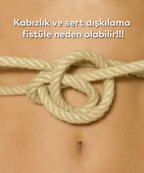 anal-fistül-kabızlık