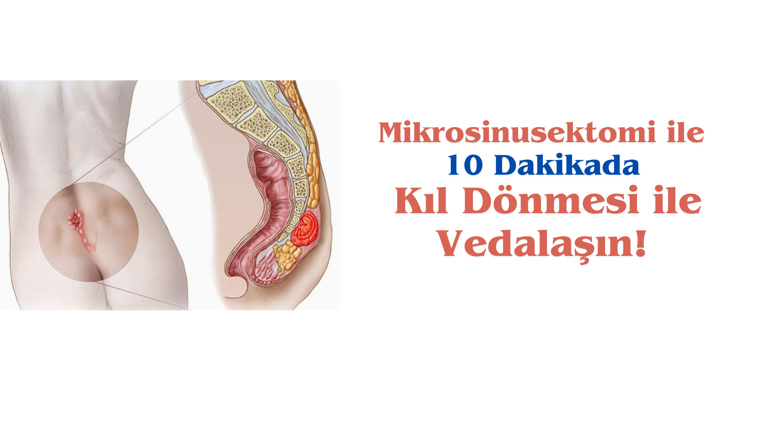 kıl dönmesi