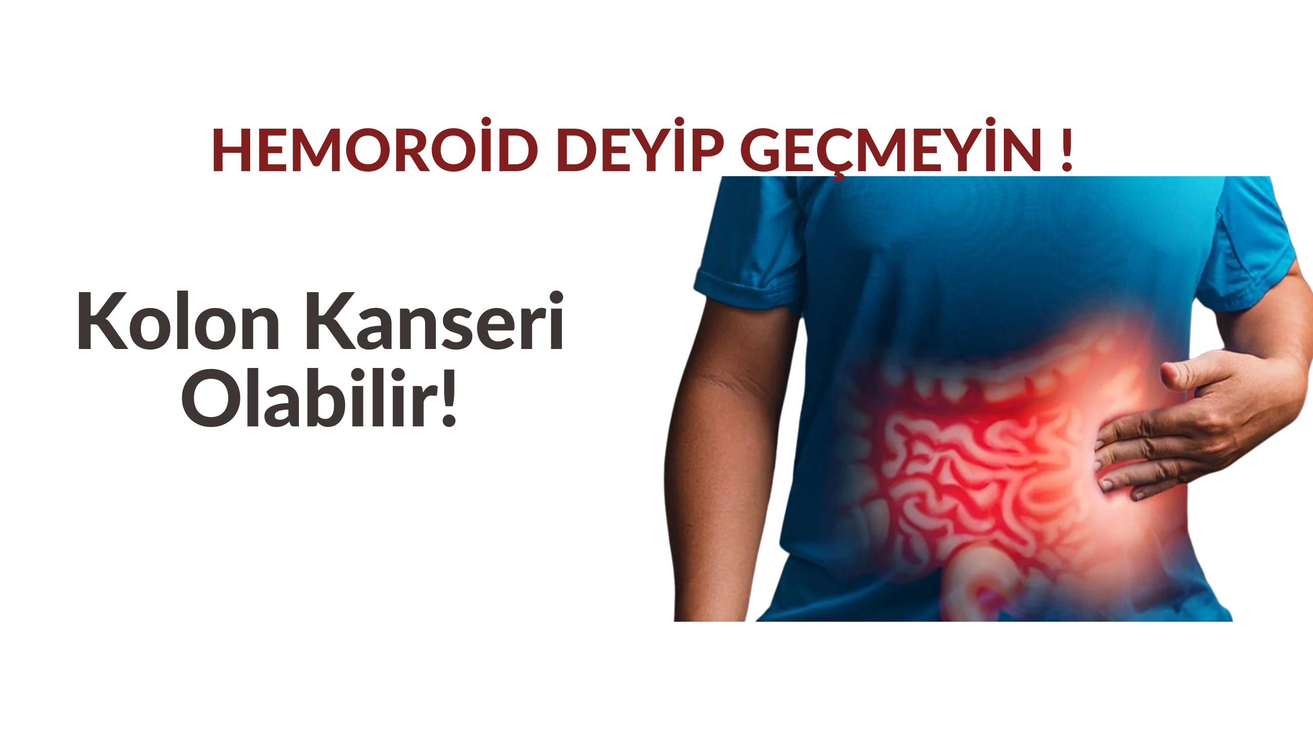 kolonkanseri (2)